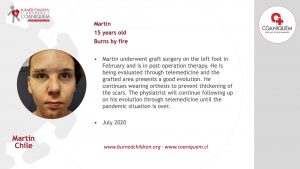 Martin